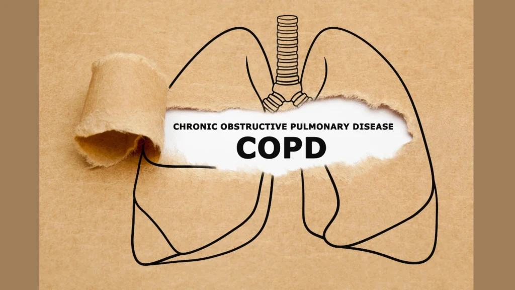 Image of respiratory disease to show how climate change can trigger air pollution, smog, and respiratory diseases.